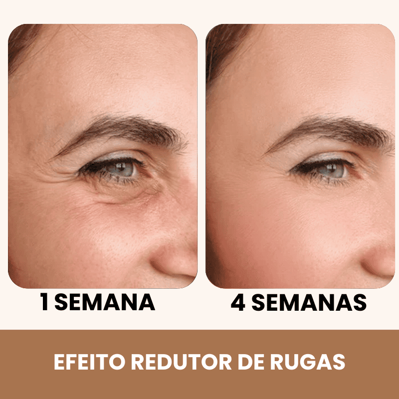 PalpeLift 3 em 1 - Pálpebra, Bolsas e Rugas