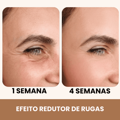 PalpeLift 3 em 1 - Pálpebra, Bolsas e Rugas