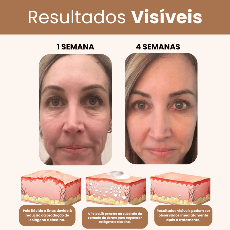 PalpeLift 3 em 1 - Pálpebra, Bolsas e Rugas