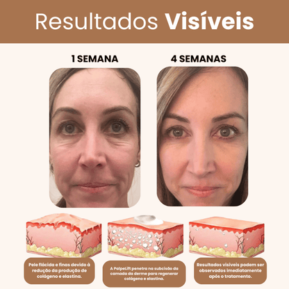 PalpeLift 3 em 1 - Pálpebra, Bolsas e Rugas