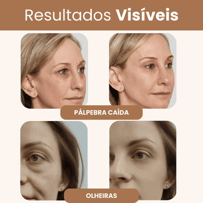 PalpeLift 3 em 1 - Pálpebra, Bolsas e Rugas