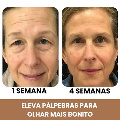 PalpeLift 3 em 1 - Pálpebra, Bolsas e Rugas
